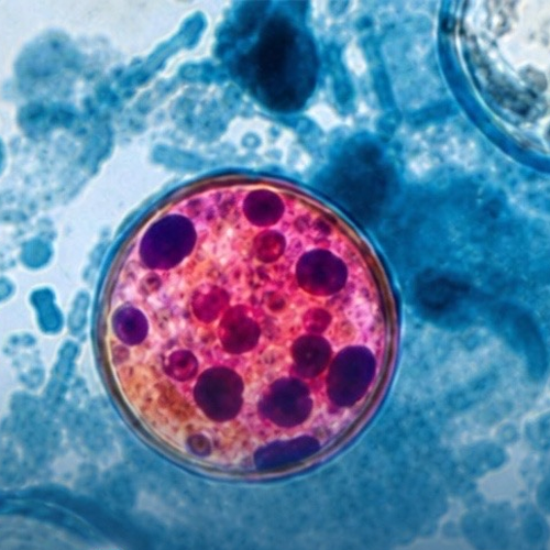 CYCLOSPORA
