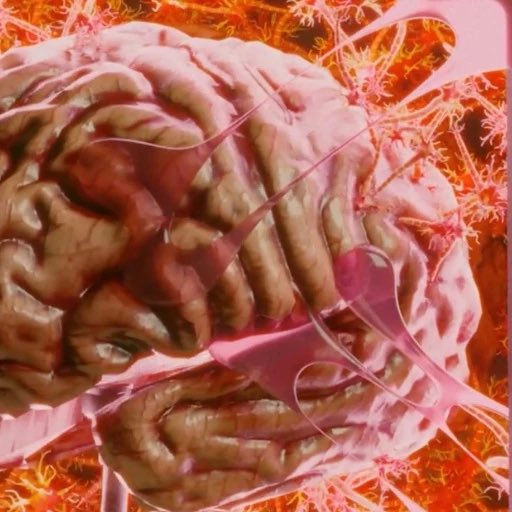 Organoid